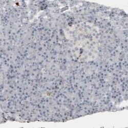 Fibronectin Antibody, Novus Biologicals 0.1 mL | Buy Online | Novus Biologicals | Fisher Scientific