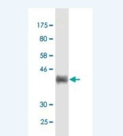 Fibulin 1 Antibody (2G9), Novus Biologicals 0.1 mg | Buy Online | Novus Biologicals | Fisher Scientific