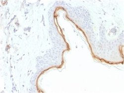 Filaggrin Antibody (FLG/1945) - Azide and BSA Free, Novus Biologicals 100 &mu;g | Buy Online | Novus Biologicals | Fisher Scientific
