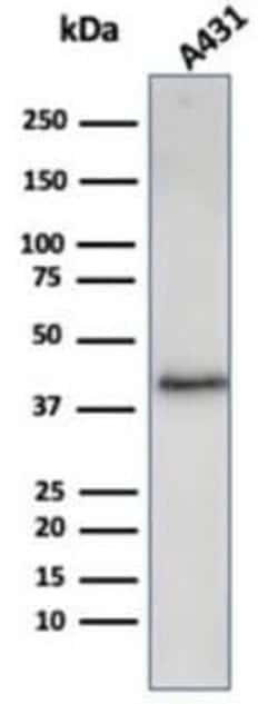 Filaggrin Rabbit anti-Human, Clone: FLG/3909R, Novus Biologicals 100 &mu;g;