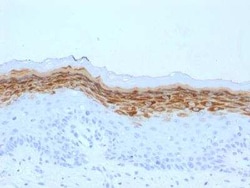 Filaggrin Antibody (FLG/1561) - Azide and BSA Free, Novus Biologicals:Antibodies:Primary