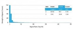 Filaggrin Antibody (FLG/1561) - Azide and BSA Free, Novus Biologicals:Antibodies:Primary