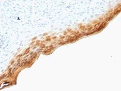 Filaggrin Antibody (SPM181), Novus Biologicals:Antibodies:Primary Antibodies