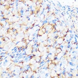 Filamin A Rabbit anti-Human, Mouse, Rat, Clone: 3X8Y9, Novus Biologicals:Antibodies:Primary