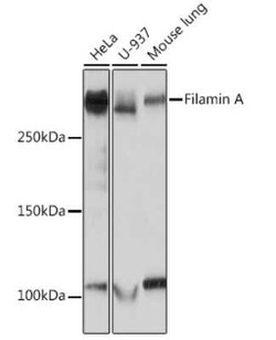 Filamin A Rabbit anti-Human, Mouse, Rat, Clone: 3X8Y9, Novus Biologicals:Antibodies:Primary