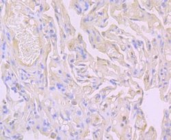 Flotillin-1 Rabbit anti-Human, Mouse, Rat, Clone: JB19-45, Novus Biologicals