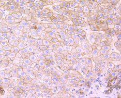 Flotillin-1 Rabbit anti-Human, Mouse, Rat, Clone: JB19-45, Novus Biologicals