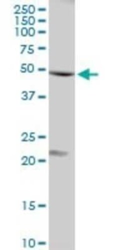 Flotillin-1 Antibody, Novus Biologicals 0.1 mg | Buy Online | Novus Biologicals | Fisher Scientific