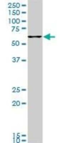 FoxC2 Antibody (1A8), Novus Biologicals 0.1 mg | Buy Online | Novus Biologicals | Fisher Scientific