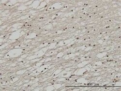 FoxC2 Antibody (2H3), Novus Biologicals 0.1 mg | Buy Online | Novus Biologicals | Fisher Scientific