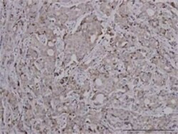 FoxC2 Antibody (2H3), Novus Biologicals 0.1 mg | Buy Online | Novus Biologicals | Fisher Scientific