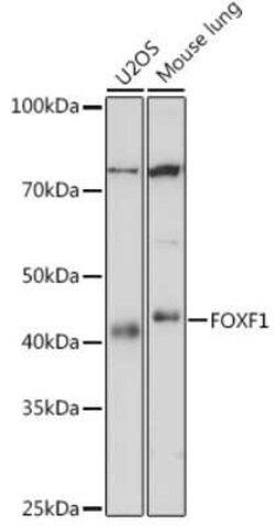FoxF1 Rabbit anti-Human, Mouse, Clone: 8F6G3, Novus Biologicals 100 &mu;g | Buy Online | Novus Biologicals | Fisher Scientific