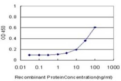 Novus Biologicals FoxF2 Antibody (2D7), Novus Biologicals 0.1 mg | Buy Online | Novus Biologicals&trade; | Fisher Scientific