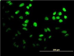 FoxF2 Antibody (2G10), Novus Biologicals 0.1 mg | Buy Online | Novus Biologicals | Fisher Scientific