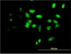 FoxF2 Antibody (3F5), Novus Biologicals 0.1 mg | Buy Online | Novus Biologicals | Fisher Scientific