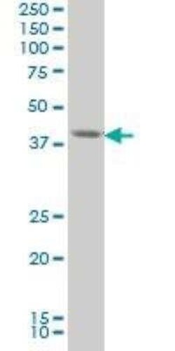 FoxF2 Antibody (3F5), Novus Biologicals 0.1 mg | Buy Online | Novus Biologicals | Fisher Scientific