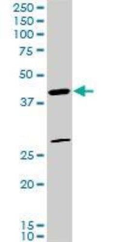 FoxF2 Antibody (3F5), Novus Biologicals 0.1 mg | Buy Online | Novus Biologicals | Fisher Scientific