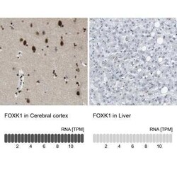 FoxK1 Antibody, Novus Biologicals 0.1 mL; Unconjugated:Antibodies, Polyclonal