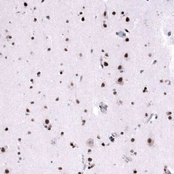 FoxM1 Mouse anti-Human, Clone: CL12131, Novus Biologicals:Anticorps:Anticorps