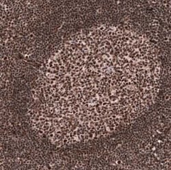 FoxM1 Mouse anti-Human, Clone: CL12131, Novus Biologicals:Anticorps:Anticorps