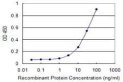 FoxM1 Antibody (2H4), Novus Biologicals 0.1 mg | Buy Online | Novus Biologicals | Fisher Scientific