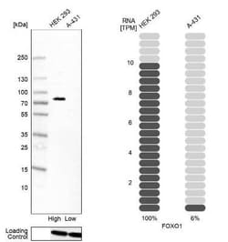 FoxO1/FKHR Antibody (CL13278), Novus Biologicals 25 &mu;g; Unconjugated:Antibodies,