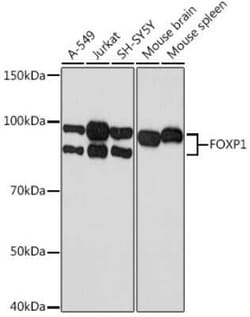 FoxP1 Rabbit anti-Human, Mouse, Rat, Clone: 2Q1R5, Novus Biologicals 100 &mu;g | Buy Online | Bio-Techne | Fisher Scientific