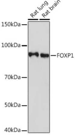 FoxP1 Rabbit anti-Human, Mouse, Rat, Clone: 2Q1R5, Novus Biologicals 100 &mu;g | Buy Online | Bio-Techne | Fisher Scientific