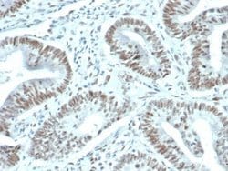 FoxP1 Antibody (FOXP1/44R) - Azide and BSA Free, Novus Biologicals 100 &mu;g | Buy Online | Novus Biologicals | Fisher Scientific