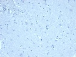 FoxP1 Rabbit anti-Human, Clone: FOXP1/44R, Novus Biologicals:Antibodies:Primary