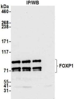 FoxP1 Antibody (BLR134H), Novus Biologicals 100 &mu;g | Buy Online | Bio-Techne | Fisher Scientific