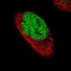 FoxP2 Antibody (CL5312), Novus Biologicals 100&mu;L:Antibodies, Monoclonal