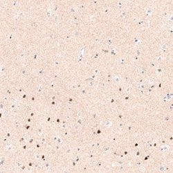 FoxP2 Antibody (CL5312), Novus Biologicals 100&mu;L:Antibodies, Monoclonal