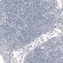FoxP2 Antibody (CL5312), Novus Biologicals 100&mu;L:Antibodies, Monoclonal