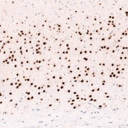 FoxP2 Antibody (CL5312), Novus Biologicals 100&mu;L:Antibodies, Monoclonal