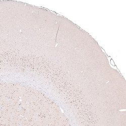 FoxP2 Antibody (CL5312), Novus Biologicals 100&mu;L:Antibodies, Monoclonal