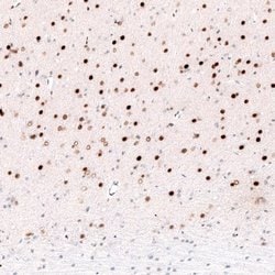 FoxP2 Antibody (CL5312), Novus Biologicals 100&mu;L:Antibodies, Monoclonal