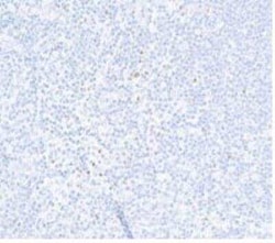 FoxP3 Antibody (BLR034F), Novus Biologicals 100 &mu;g; Unconjugated:Antibodies,