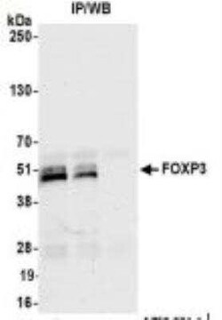 FoxP3 Antibody (BLR034F), Novus Biologicals 100 &mu;g; Unconjugated:Antibodies,