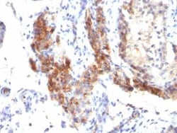 FoxP3 Mouse, Clone: SPM579, Novus Biologicals:Antibodies:Primary Antibodies