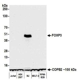 FoxP3 Antibody (BLR034F), Novus Biologicals 100 &mu;g; Unconjugated:Antibodies,