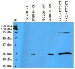 Francisella tularensis ssp. tularensis antigen FTT0571 Antibody, Novus