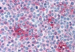 Frizzled-1 Antibody, Novus Biologicals 50 &mu;g; Unconjugated:Antibodies,