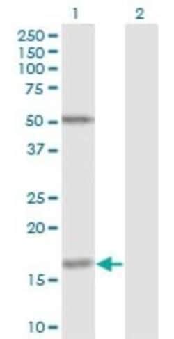 Fucosyltransferase 2/FUT2 Antibody (4C12), Novus Biologicals 0.1 mg; Unconjugated:Antibodies,
