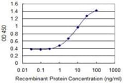 Fucosyltransferase 5/FUT5 Antibody (1H6), Novus Biologicals 0.1 mg | Buy Online | Novus Biologicals | Fisher Scientific