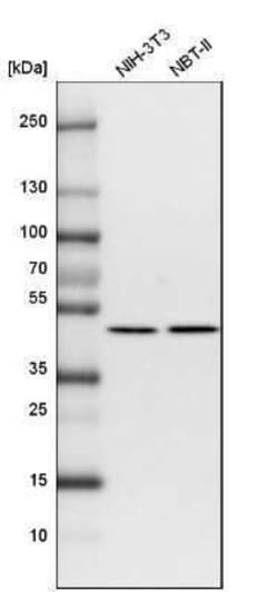 Fumarase Antibody, Novus Biologicals:Antibodies:Primary Antibodies