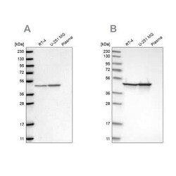 Fumarase Antibody, Novus Biologicals:Antibodies:Primary Antibodies