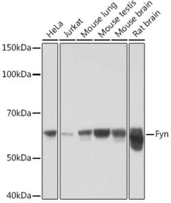 Fyn Rabbit anti-Human, Mouse, Rat, Clone: 7Z9F2, Novus Biologicals 100