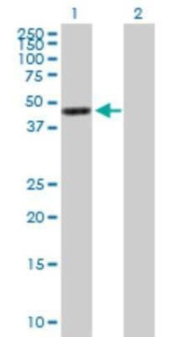 G protein alpha 16 Antibody, Novus Biologicals 0.05 mg, Unconjugated:Antibodies,