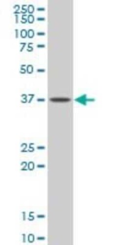 Novus Biologicals G protein alpha Inhibitor 2 Antibody (2E4), Novus Biologicals